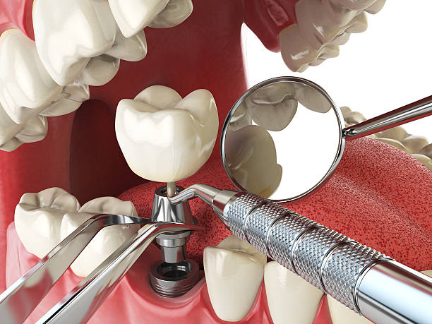 Best Emergency Orthodontic Services in Albemarle, NC